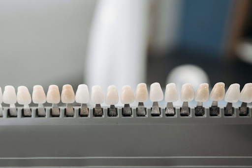 Display of composite or porcelain veneers at dentist office