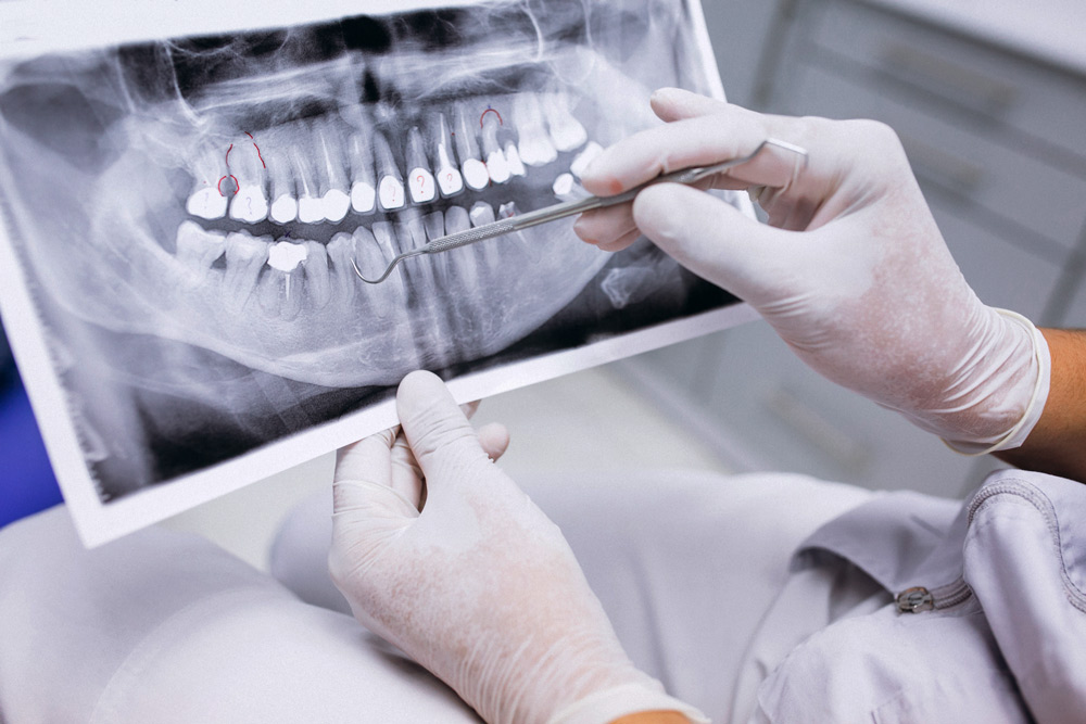 A Simple Guide to Types of Dental Xrays